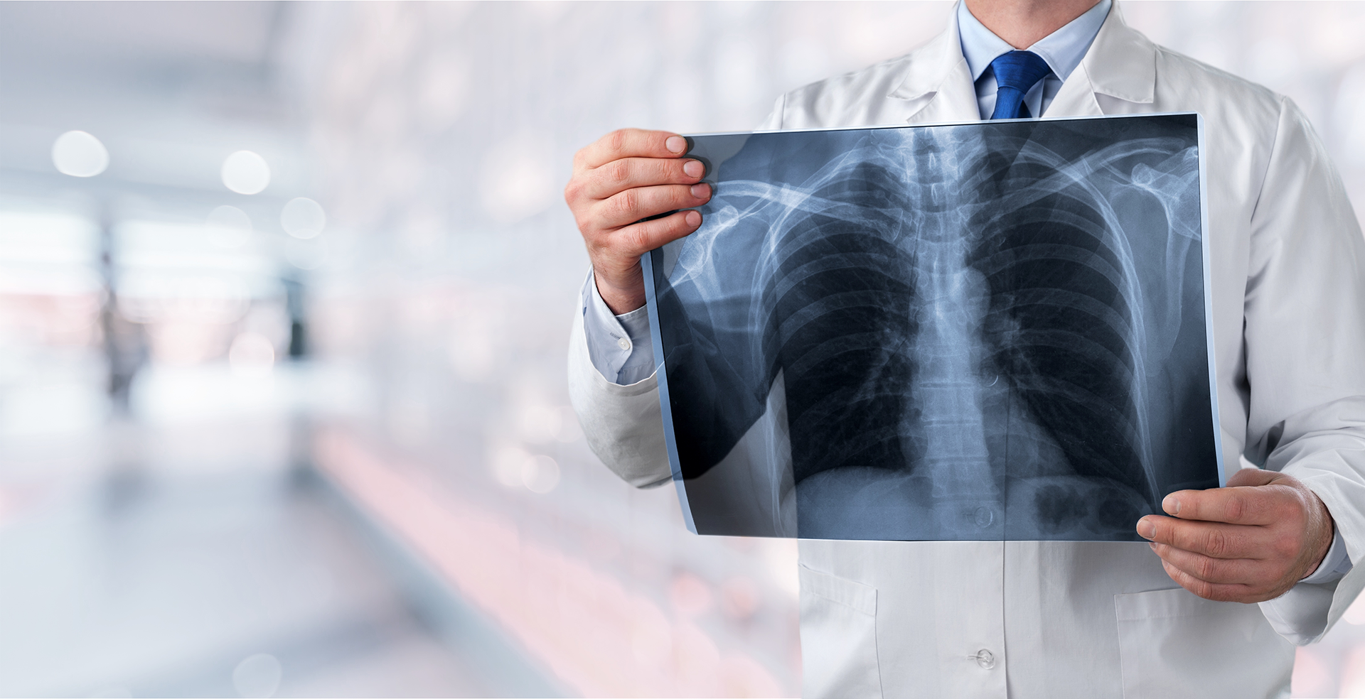Doctor holding a chest x-ray image